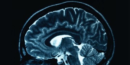 10929-cerveau scan
