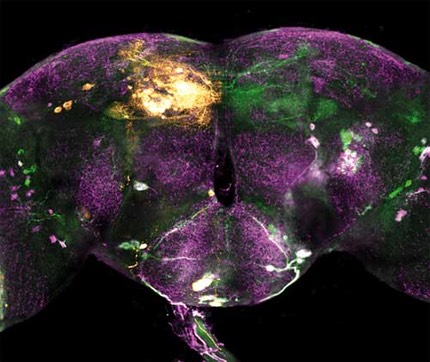 Cerveau mouche- dro